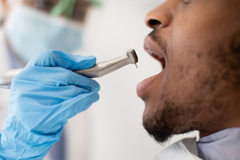 Dental White Fillings, North Vancouver